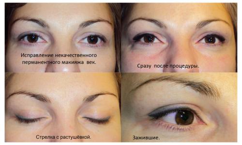 Что такое Рефреш бровей. Рефреш бровей, что это — Когда необходимо делать обновления 18