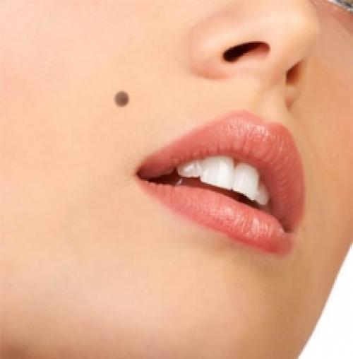 Мушка косметическая. Косметическая мушка