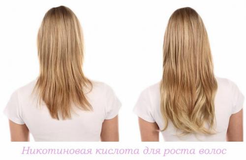 Длинные волосы. Хитрость №1: Изучаем подшерсток