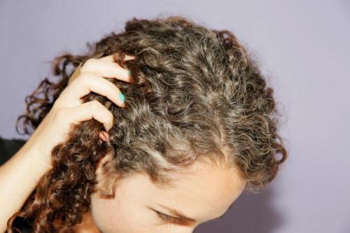 Седеют волосы с правой стороны. Что на самом деле происходит, когда волосы начинают седеть? (7 фото)