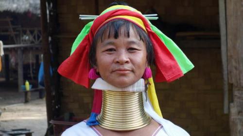 Самая большая шея в обхвате. За какие самые длинные части тела эти люди попали в Книгу рекордов Гиннеса? (10 фото)