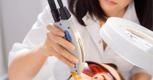 Лазерные процедуры для лица от прыщей. Лечение акне лазером