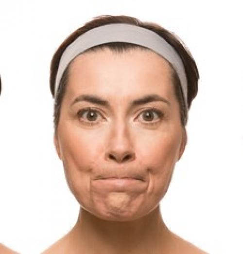 Как убрать брыли на лице методы и процедур. Убираем брыли и подтягиваем овал лица