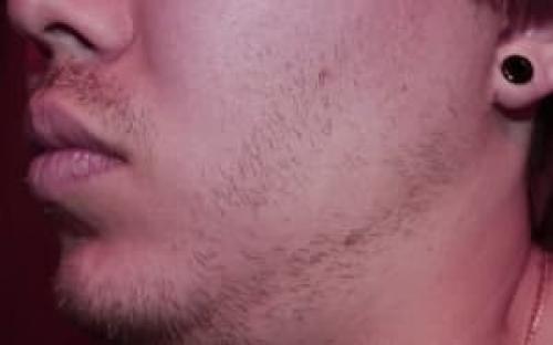 Как правильно начать растить бороду. Причины, почему борода не растет