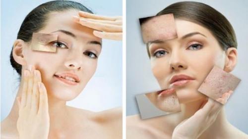 Виды лазеров в косметологии. Преимущества и недостатки лазерной косметологии