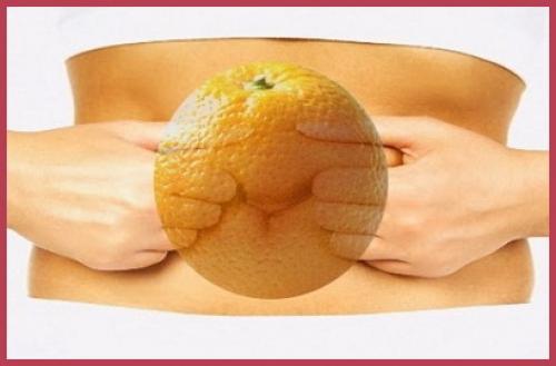 От чего появляется целлюлит на ногах и как от него избавиться. Выявляем стадию запущенности