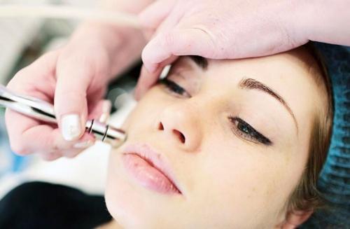 Алмазный пилинг в косметологии, что это такое. Что такое микродермабразия?