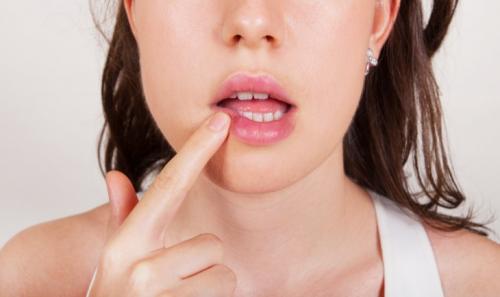 Малавит от пятен после прыщей. Положительные свойства «Малавита»