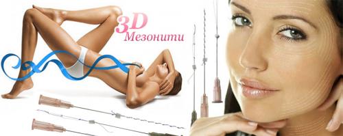 Тредлифтинг схемы. Мезонити