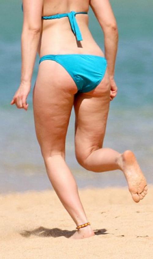 Почему целлюлит появляется у худых. Целлюлит у худых: причины появления и способы избавления