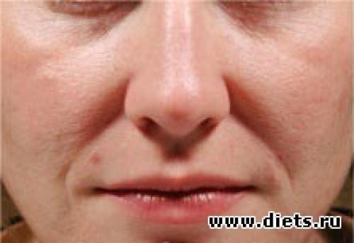 Массаж асахи от носогубных складок. Разглаживаем носогубки: два эффективных массажных приема