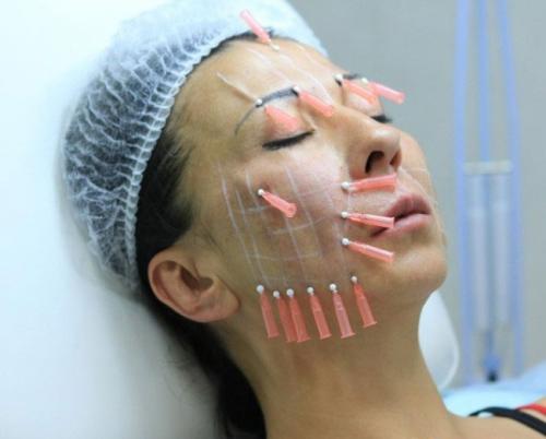 Какими процедурами можно подтянуть овал лица. Лучшие способы подтяжки овала лица и контура