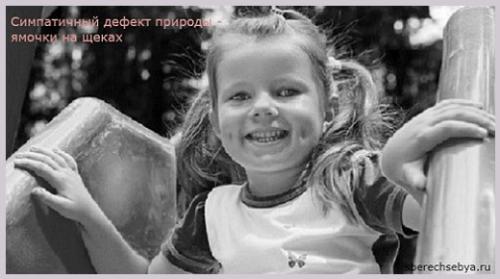 Как избавиться от ямочек на щеках. Ямочки на щеках — привлекательный дефект.