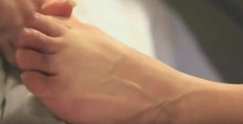 Больно ли удалять вросший ноготь на ноге