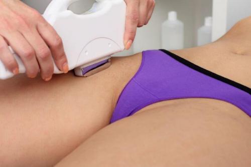 Отбеливание кожи между ног в салоне. Как отбелить кожу при витилиго и пигментации