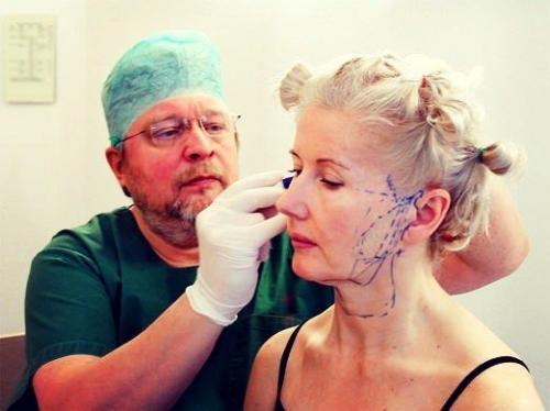 Как убрать брыли на лице методы. Брыли: как убрать обвисшие щеки. Косметология, упражнения и пластика