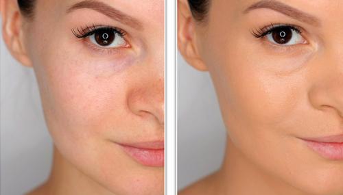 Матирующий Дневной крем для лица, что это такое. Особенности использования