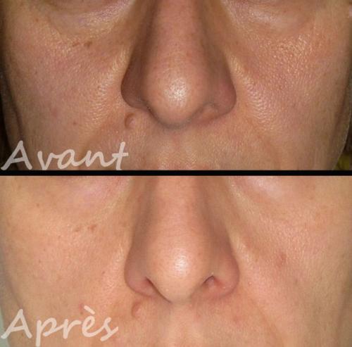 Юкуко Танака японский массаж лица. Юкуко Танака и двухпальцевый массаж Зоган (Zogan)