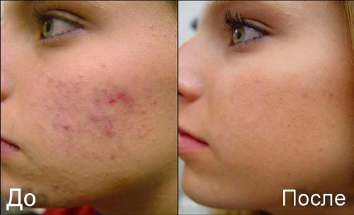 Маска для лица с алоем в домашних условиях рецепт.