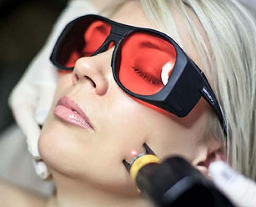 Аппаратная и лазерная Косметология. О косметологических лазерах и лазерных системах