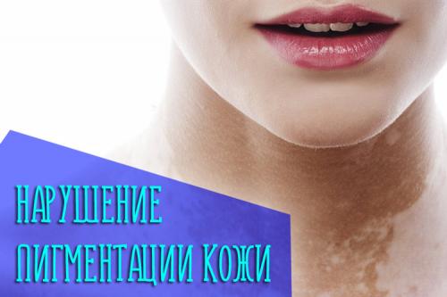 Пигментация кожи белые пятна причины. Причины пигментации кожи и появление белых пятен