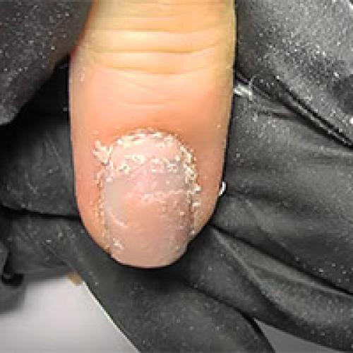 Жидкость для снятия гель-лака, как пользоваться. Как снять лак-гель без специальной жидкости