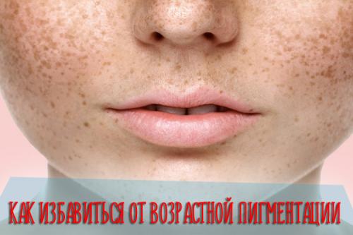 Пигментация кожи возрастная причины. Причины появления