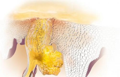 Уход за кожей для лица склонного к акне. Как помочь проблемной и склонной к акне коже?