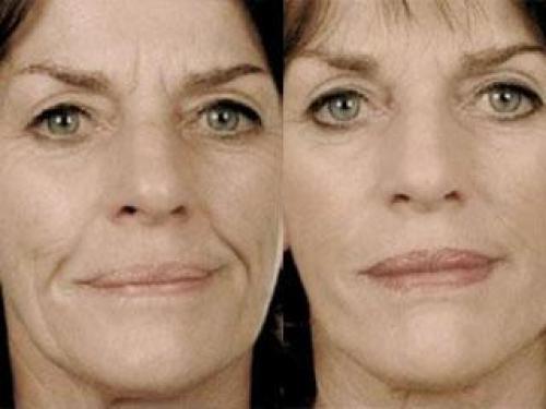 Японский массаж для лица Асахи 2 после 40 и 50 лет. Ожидаемый эффект