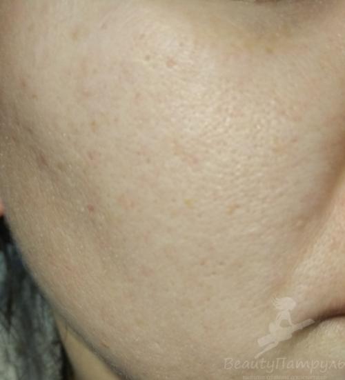 Крем для лица Чистая линия дневной легкий Увлажняющий. Мой отзыв о дневном креме для лица «Легкий увлажняющий» от компании «Чистая линия»