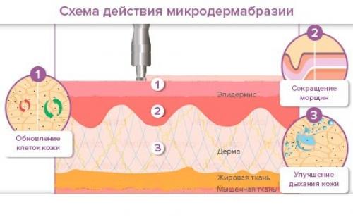 Крем для осветление кожи в интимных местах. Как отбелить кожу в салоне в зоне бикини от загара