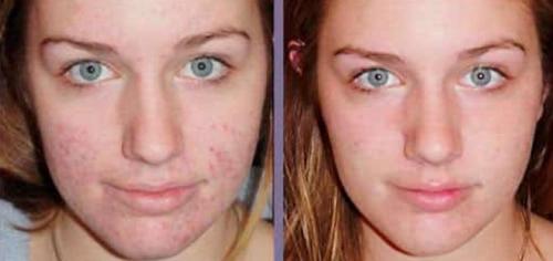 Алоэ маски для лица. Отзывы женщин о применении масок для лица с алоэ