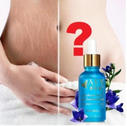 Удаление растяжек хирургическим путем. Как лечить растяжки