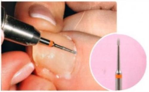 Аппаратный маникюр пошагово. Аппаратный маникюр: пошаговое руководство для начинающих