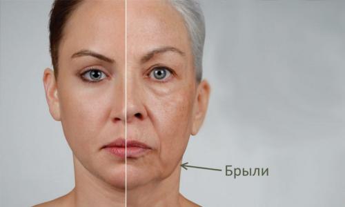 Как избавиться от брылей на лице в домашних условиях
