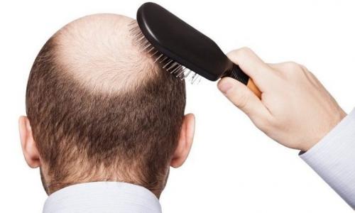 Рост волос от чего зависит. Рост 04 Рост волос от чего зависит. Рост 04