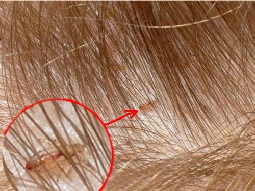 Невская косметика шампунь дегтярный состав. Как работает дегтярный шампунь 03 Невская косметика шампунь дегтярный состав. Как работает дегтярный шампунь 03