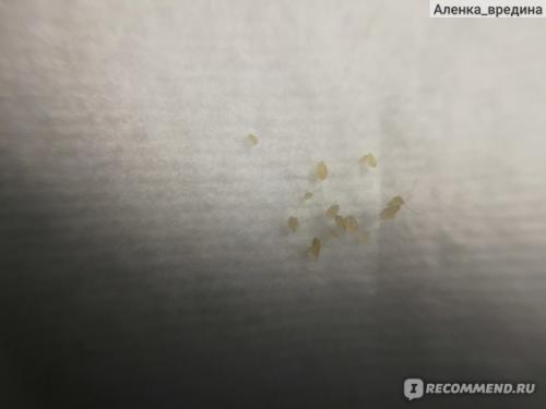 Как почистить кожу головы от сальных пробок в домашних. Масло касторовое