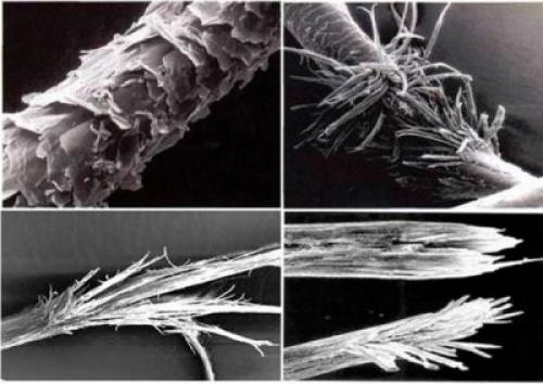 Секущиеся волосы у мужчин. Что представляют собой секущиеся кончики волос?