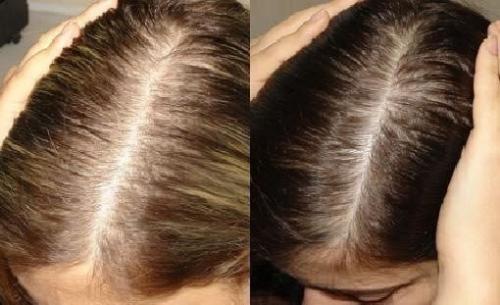 Советы трихолога по уходу за жирными волосами. Как бороться с жирными корнями волос? 01 Советы трихолога по уходу за жирными волосами. Как бороться с жирными корнями волос? 01