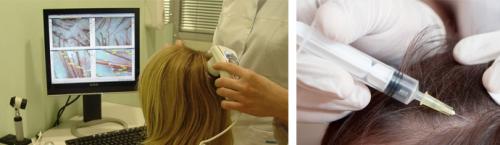 Constant Delight маска для корней волос стимулирующая рост. Маска для корней стимулирующая рост волос Constant Delight Maschera Per Radici 250 мл 02