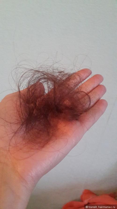 Как бороться с выпадением волос у женщин. Как бороться с сильным выпадением волос?