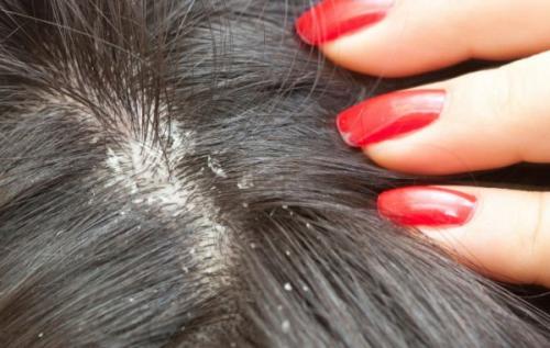 Как приучить волосы мыть реже. Как приучить голову к более редкому мытью?