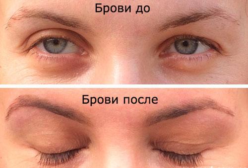 Репейное масло с красным перцем для бровей. В чем польза продукта?