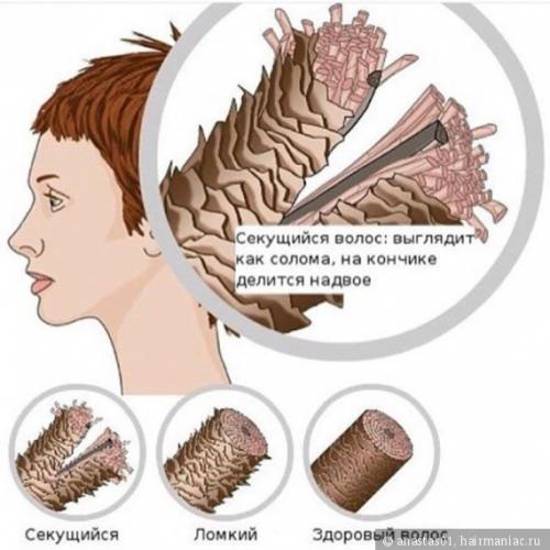 Волосы секутся по всей длине форум. Сечение волос по всей длине. Как я справляюсь