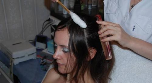 Как избавиться от перхоти в домашних условиях быстро и эффективно. Как избавиться от перхоти