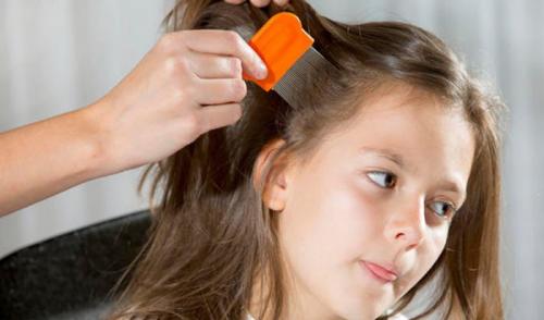 Как избавиться от перхоти в домашних условиях за 1 раз. Причины появления 04