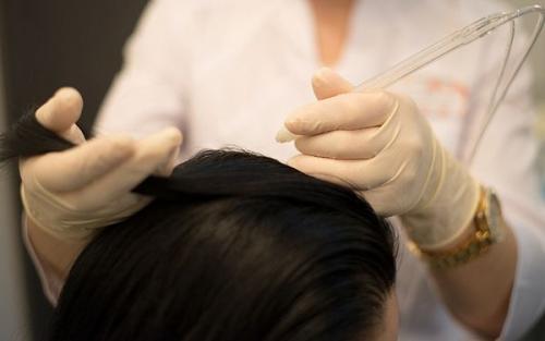 Пилинг кожи головы в домашних. Зачем нужен пилинг кожи головы? 05 Пилинг кожи головы в домашних. Зачем нужен пилинг кожи головы? 05