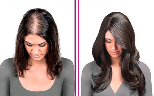 Как оживить луковицы волос. Как восстановить волосяную луковицу 01