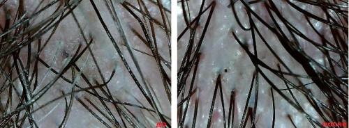 Можно ли скраб для тела наносить на голову. Как действует скраб на кожу головы и волосы?